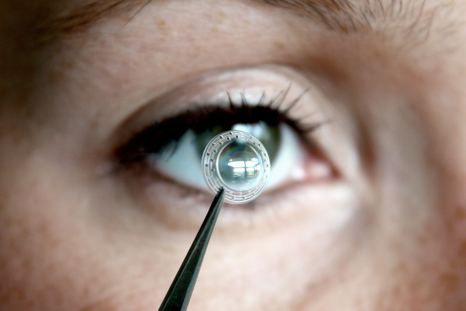 eye donation